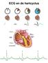 ECG en de hartcyclus