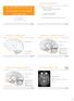 Anatomie zijaanzicht. Anatomie midden aanzicht. Substantia nigra - MRI. Anatomie midden aanzicht. Ziekte van Parkinson