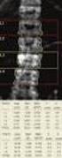 Compare patient BMD to reference values. 1.100 Peak Bone Mass = 1.047 1.050 1.000 0.950 0.900 Z=-0,4 0.700 BMD = 0.700 0.