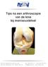 Tips na een arthroscopie van de knie bij meniscusletsel