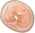 Gynaecologie / obstetrie Een miskraam of bloedverlies in de eerste maanden van de zwangerschap