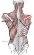 Spiergroep Spier (onderdeel) Origo Insertie Innervatie Functie Ventrale spieren van de bovenarm (flexoren onderarm)