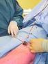 Behandeling van spataderen (varices) Afdeling Chirurgie / Dermatologie