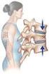 Osteoporose. Fractuur-management