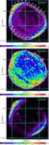 X-ray spectral analysis of non-equilibrium plasmas in supernova remnants Broersen, S.