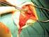 Liesbreuk operatie bij kinderen en baby s Chirurgie Waregem O.L.V. van Lourdes Ziekenhuis