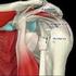 Rotator cuff scheur. Orthopedie