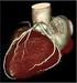 CT-onderzoek van het hart (Cardiale-CT)