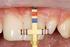 Aesthetic analysis of natural anterior teeth and their restoration with resin composites Ardu, S.