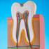 Endodontische diagnostiek