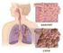 Inflammation in chronic obstructive pulmonary disease : its assessment and the effects of corticosteroids Boorsma, M.