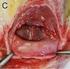 Ultrasound stimulation of mandibular bone defect healing Schortinghuis, Jurjen