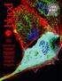 Citation for published version (APA): Jansen, L. (2000). Sentinel node biopsy. Evolving from melanoma to breast cancer