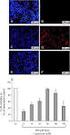 Mechanisms of oxidative stress-induced cell death in hepatocytes Conde de la Rosa, Laura