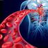 PCI of complex coronary lesions, new stent technologies, and clinical outcomes Beijk, M.A.M.