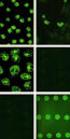 Anti-proteinase 3 and anti-myeloperoxidase associated systemic vasculitis Franssen, Casper