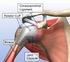 Degenerative full thickness rotator cuff tears Lambers Heerspink, Frederik