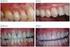 Effects of dental implants on hard and soft tissues Tymstra, Nynke