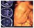 Quality assessment of prenatal cytogenetic diagnosis Raddatz, Birgit