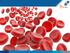 Anemie, reticulocyten & IUT s in hemolytische ziekte van de foetus en pasgeborene. Consortium transfusiegeneeskunde Isabelle Ree
